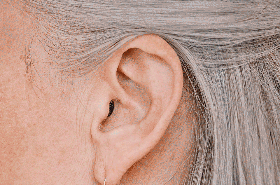 apparecchi invisibili