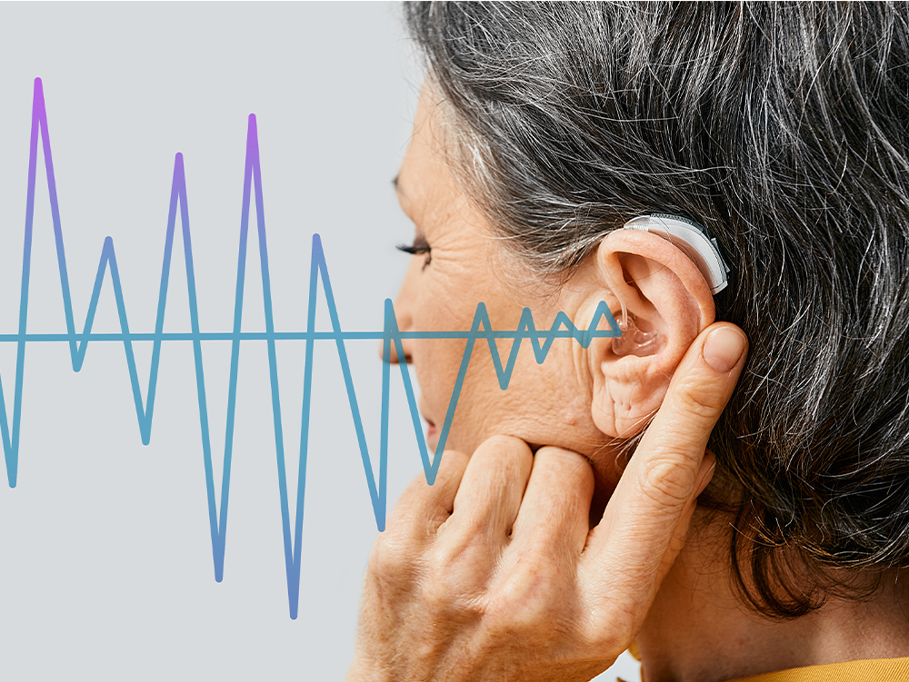 prova apparecchio gratuita